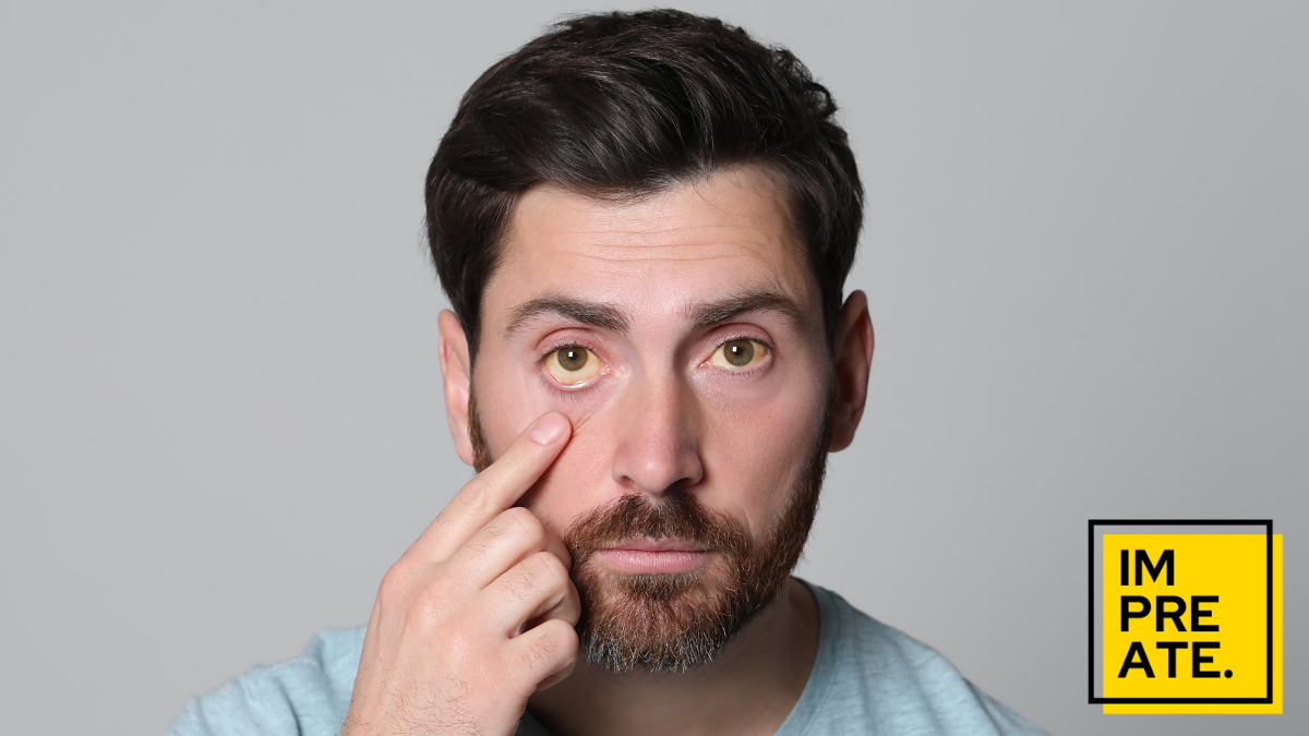 ทำความเข้าใจกับโรคดีซ่าน