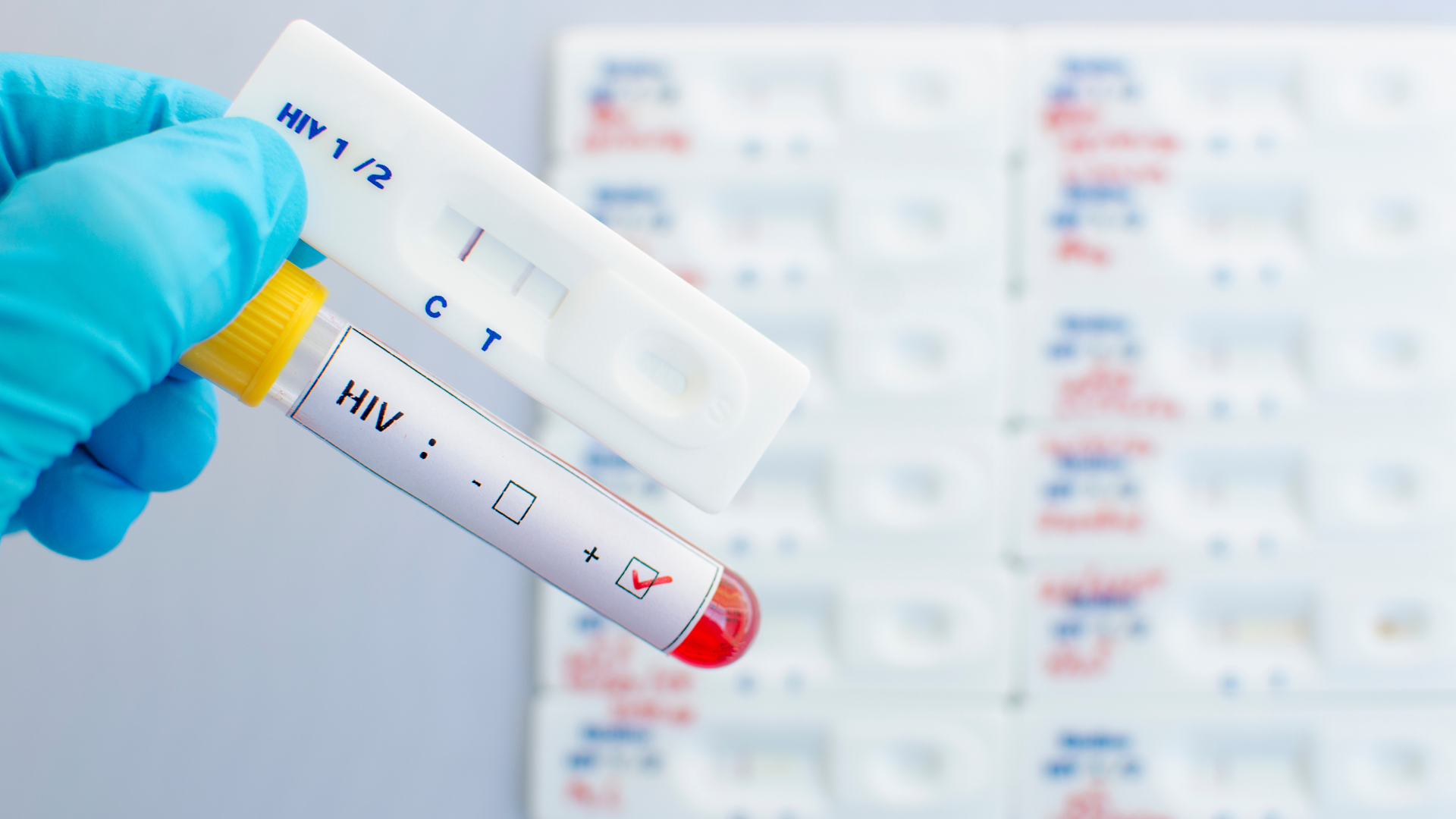 ตรวจ HIV หลังเสี่ยงกี่วันถึงน่าเชื่อถือ ทำไมไม่ควรรีบตรวจเร็วเกินไป